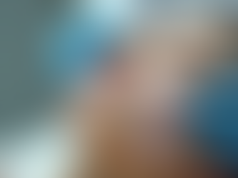 Effective Melasma Remedies in the UK