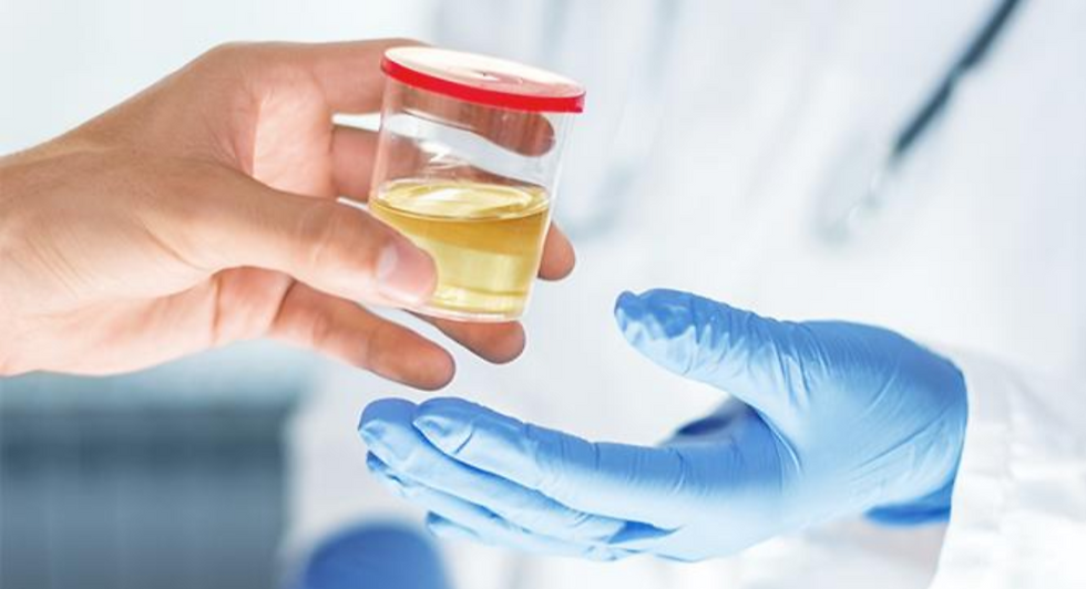 thumbnaiurine