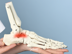 Sinus-Tarsi-Syndrom im Fuß – Schmerzen im äußeren Sprunggelenk zwischen Talus und Calcaneus