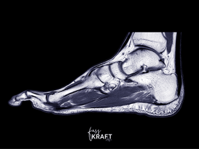 MRT Bild Fuß, Kraft, Fusskraft Allgäu