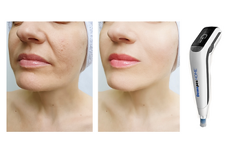 Untitled design (44).png