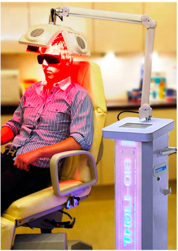 育毛 レーザー照射 血行促進マシン | 大阪 ALL in ONE 