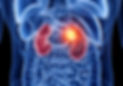 Kidney Cancer Treatment