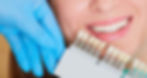hero-veneers-shades.jpg