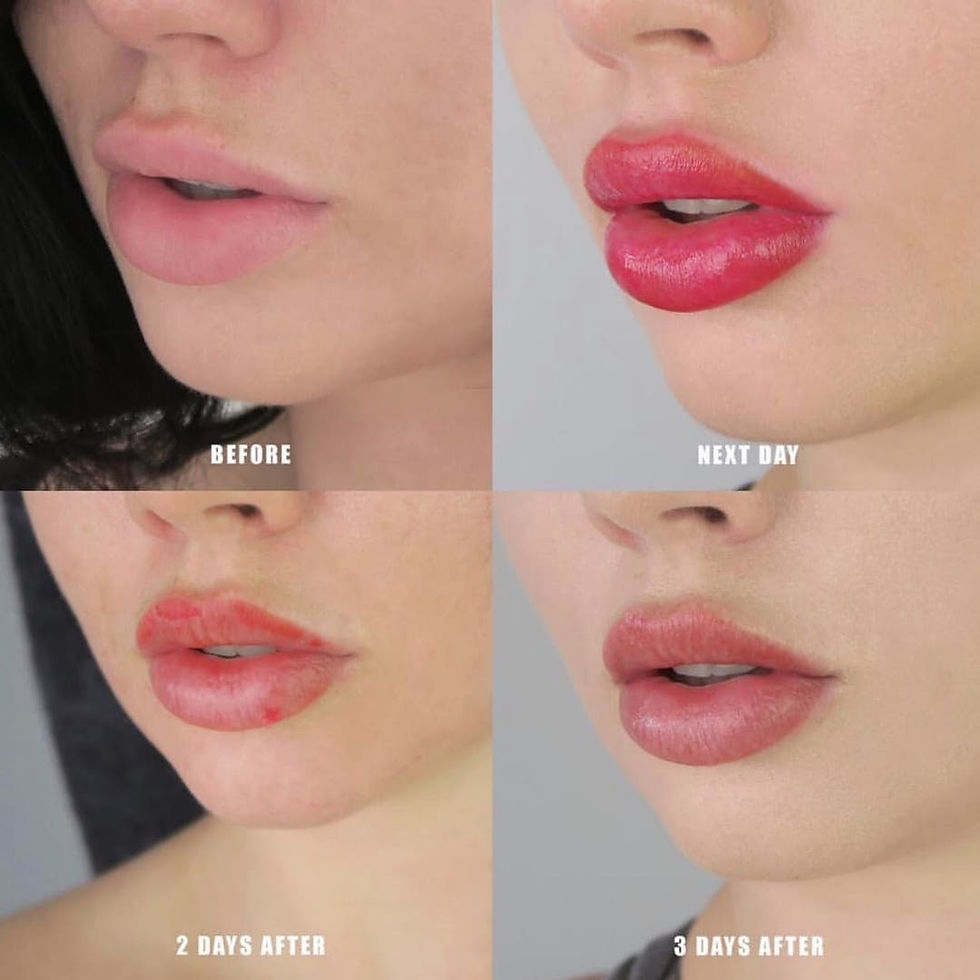 Thumbnail: 3 DAYS INTENSE  LIP BLUSH TRAINING