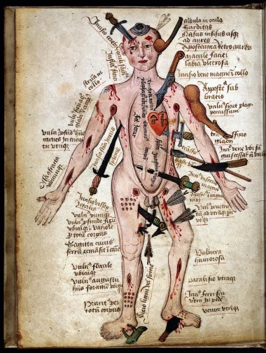 L'homme blessé médiéval.webp