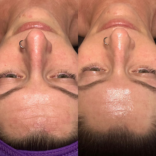 Pam before and after.JPEG