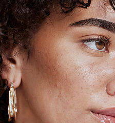 Woman with freckles_edited.jpg