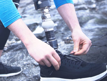 Prosthetic Feet - An Overview