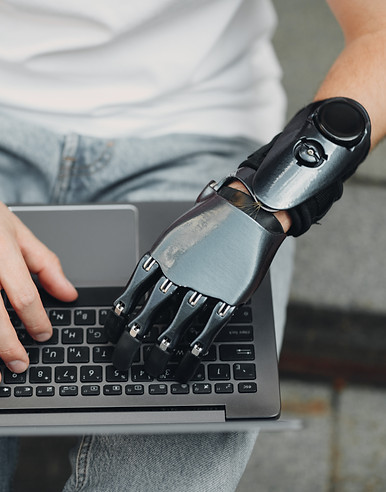 Typing with Prosthetic Hand_edited.jpg