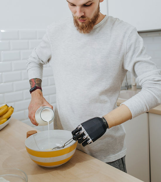 A below elbow amputee using an advanced prosthetic hand to cook. Bionic hand.