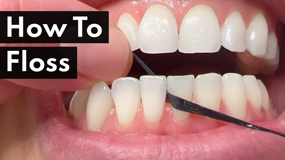 What are the Techniques of Dental Flossing