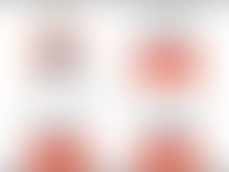 Treatment Options and Advances in Cataract Surgery