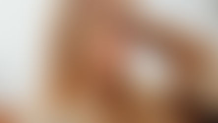 Napięciowe bóle głowy 