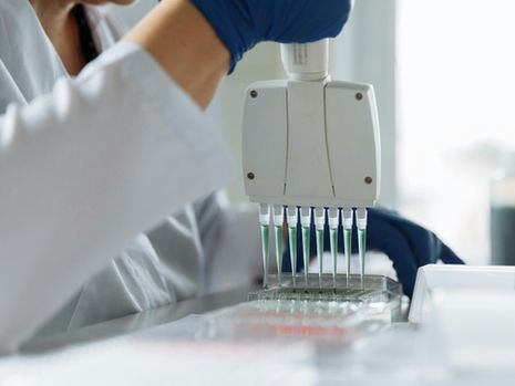 Photo of a scientist holding a multichannel pipette