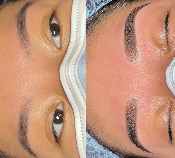 Microblading touch up