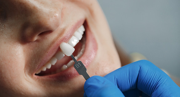 dentist-whiting-teeth.jpg