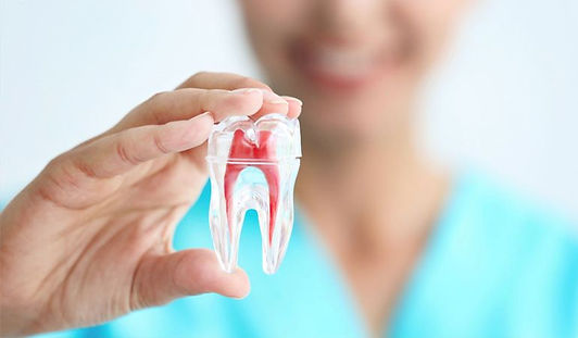 WHAT IS ROOT CANAL THERAPY AND DO I NEED ONE (1).jpg
