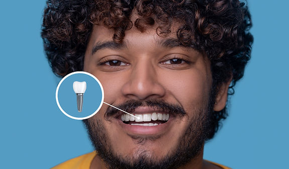 young-man-with-toothy-smile-demonstrating-his-dental-implant.jpg
