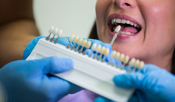 dentist-examining-female-patient-with-teeth-shades.jpg