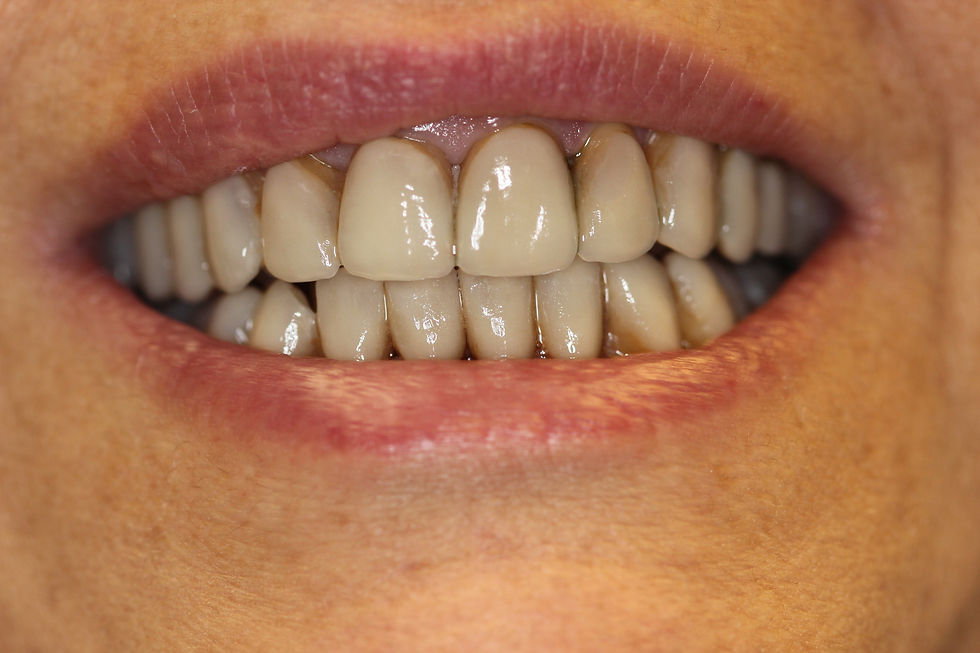 Case Study 3 - Before