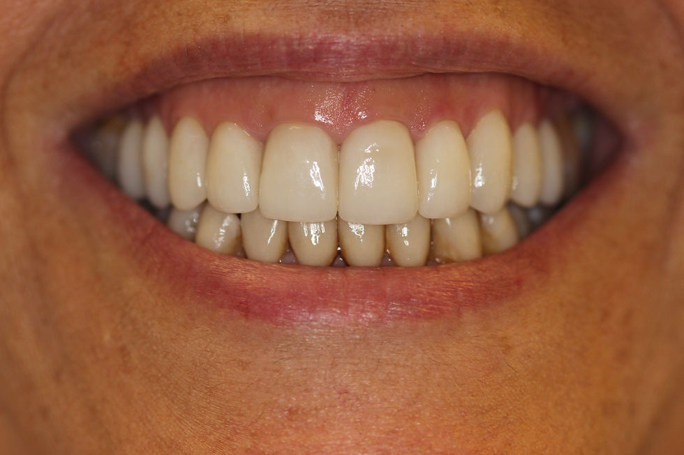 Case Study 3 - After