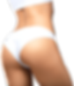 VIO脱毛