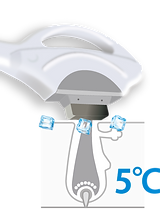 業務用脱毛機冷却5℃