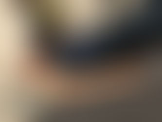 The Journey to Frozen Shoulder Recovery: Embracing Patience, Persistence, and the Power of Mindset