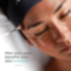 A woman with eye patches has a facial peel applied with a brush. Text reads: "How your peel benefits your skin instantly."