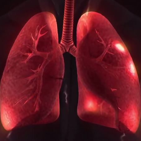 Lungs cancer causes, symptoms and treatment
