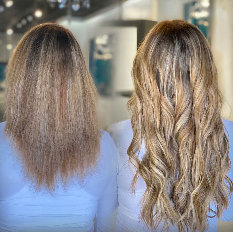 non surgical hair restoration women dallas
