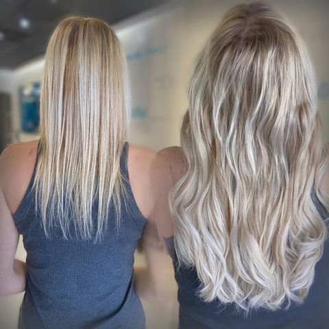 non surgical hair restoration women dallas
