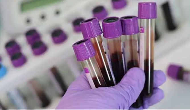 Haemophillia's patients face tough time in accessing treatment covid 19 pandemic