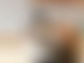 Queimaduras: o que fazer (e o que não fazer)?