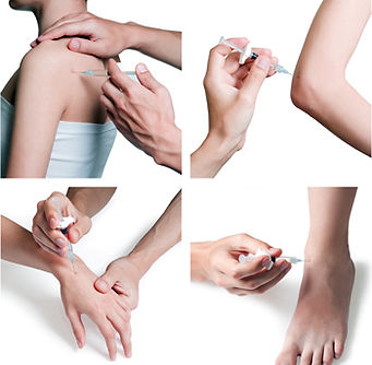 Tratamiento de dolor miofascial infiltraciones
