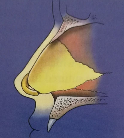 CIRUGIA DE TABIQUE.jpg