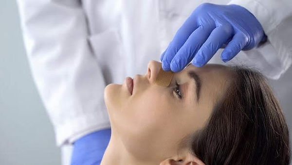 Riniplastía Chihuahua.jpg