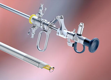 Histeroscopía | infertilidadlima