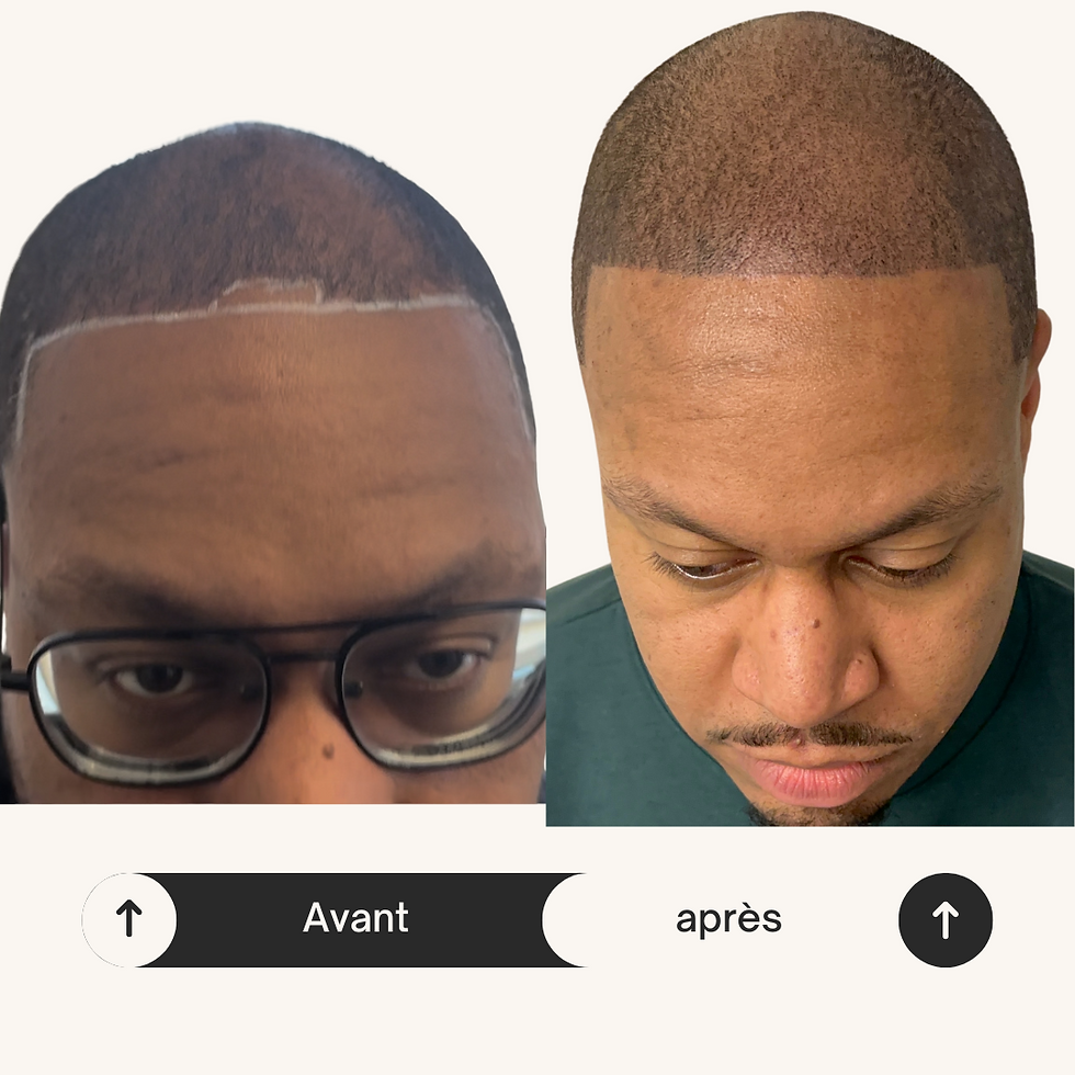 Densité et ligne frontale