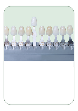 Whitening chart