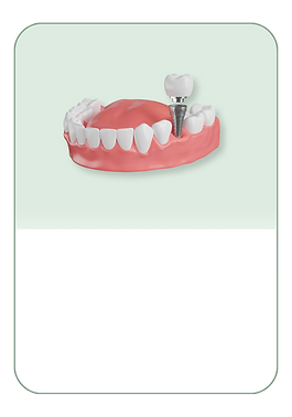 Dental Implants