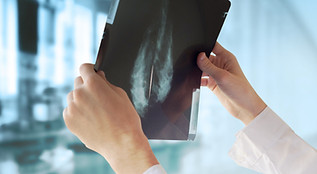 Doctor with Mammography