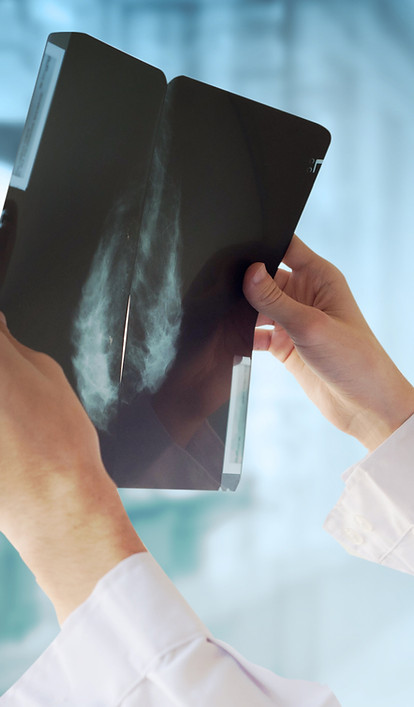 Doctor with Mammography