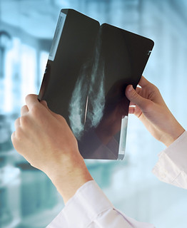 Doctor with Mammography