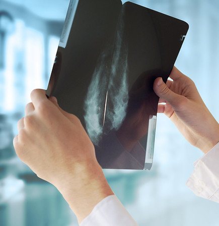 Doctor with Mammography
