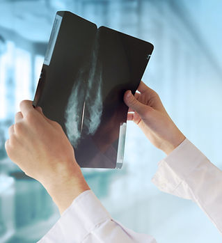 Doctor with Mammography