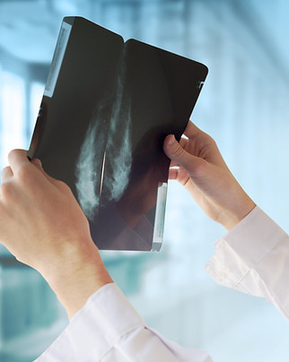 Doctor with Mammography