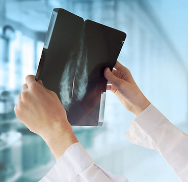 Doctor with Mammography