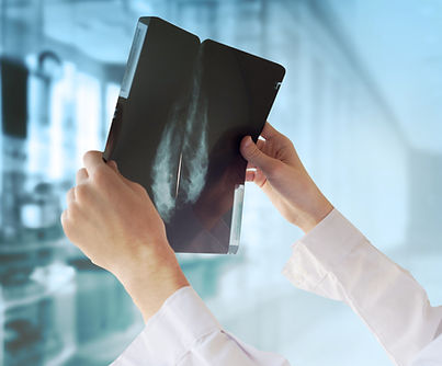 Medico con mammografia